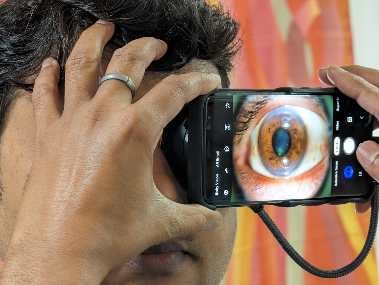 A person uses Visilant's smartphone attachment, and the phone screen displays a zoomed-in view of a patient's eye — AI