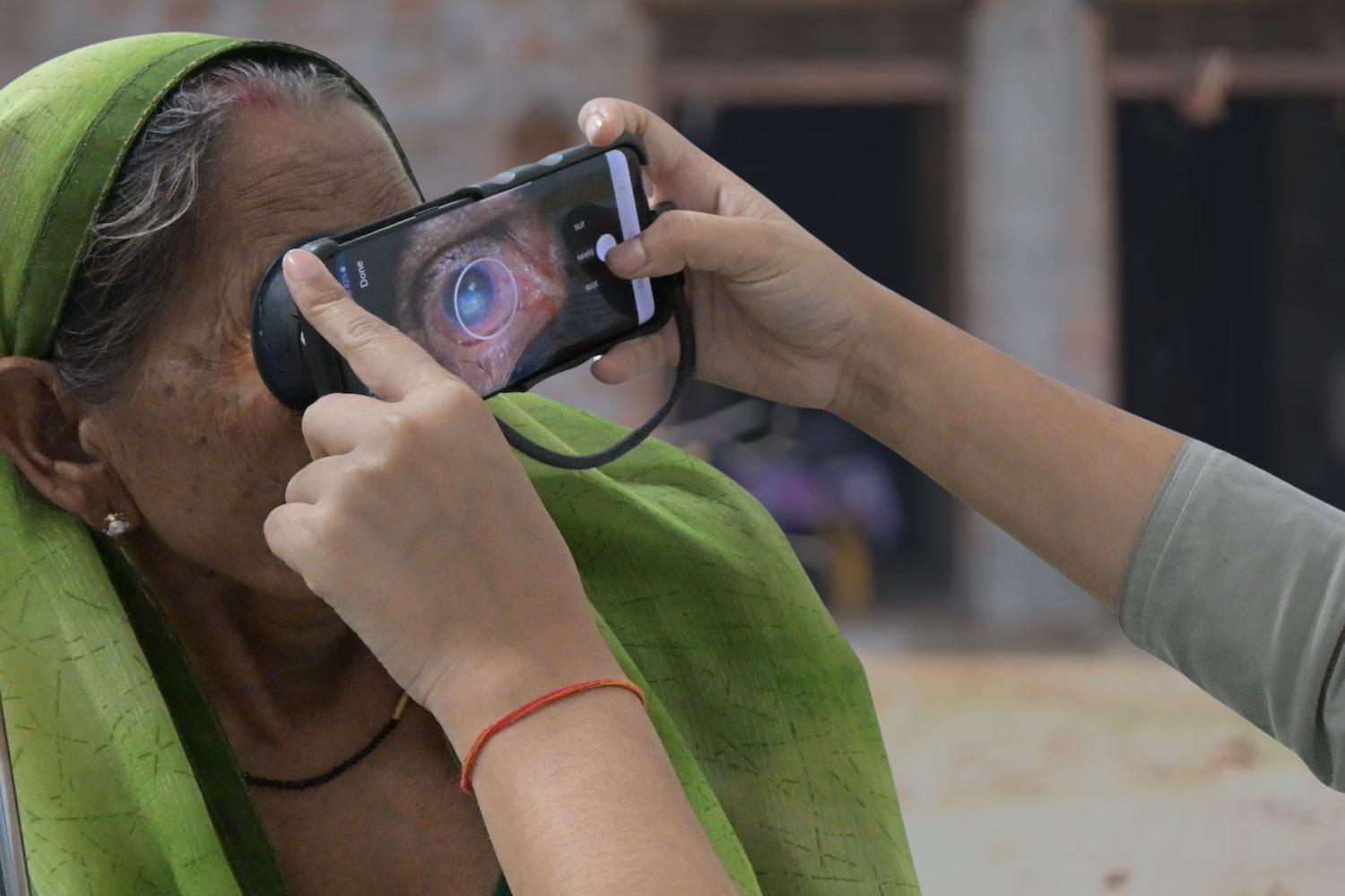 A person uses Visilant's smartphone attachment to take close-up images of another person's eye — AI