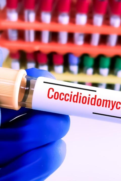 A gloved hand holds a vial of blood labeled "coccidioidomycosis," the scientific name for Valley Fever.